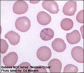 Babesiosis Cases Increasing According to Medicare Databases Study
